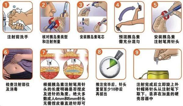 科技重塑生活，智能胰岛素注射系统引领未来注射革新视频分享