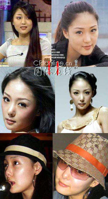 整容后遗症明星的心灵与自然美景之旅探索