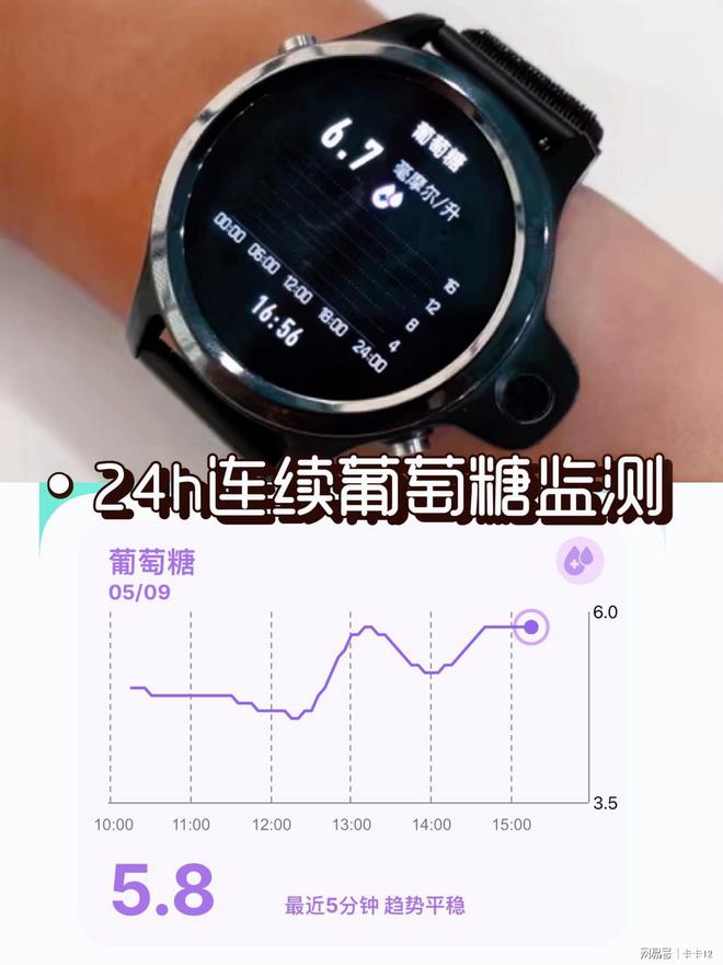 最新血糖监测手表,健康密码随手掌握💖