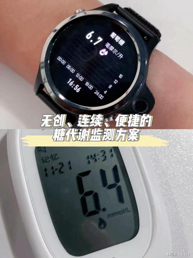 最新血糖监测手表,健康密码随手掌握💖