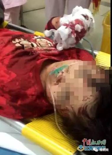 砍树冒险之旅,最新砍人图片分享