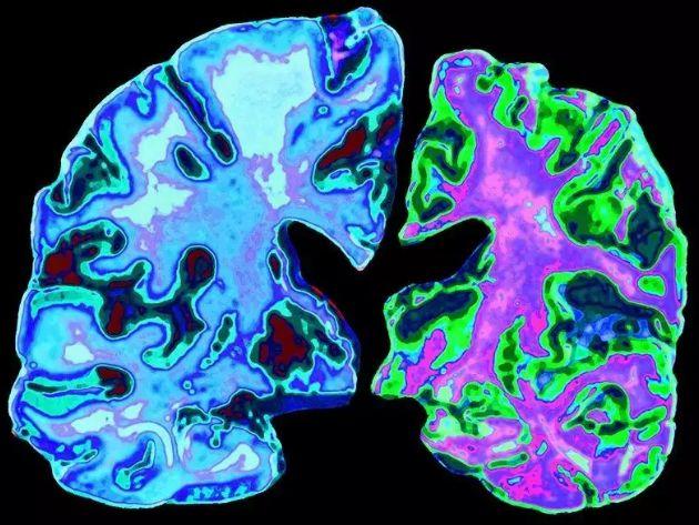 全球最新治精神病药物，打开心灵之窗，重塑自信与成就之源