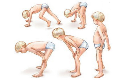 最新肌肉营养不良资讯,步骤指南、技能学习与相关资讯全解析