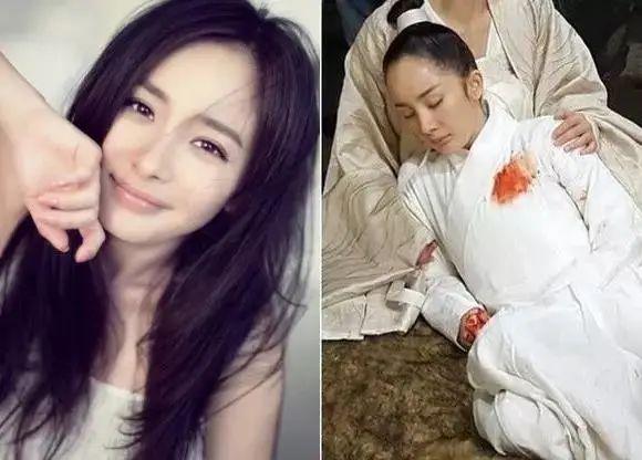 公众人物脱发现象,明星的头发问题与公众观点的关注焦点