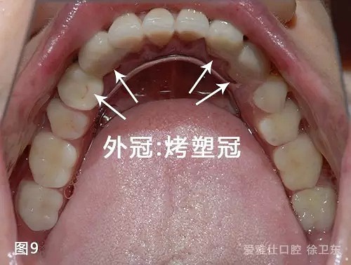 最新活动义齿与友情盛宴盛启