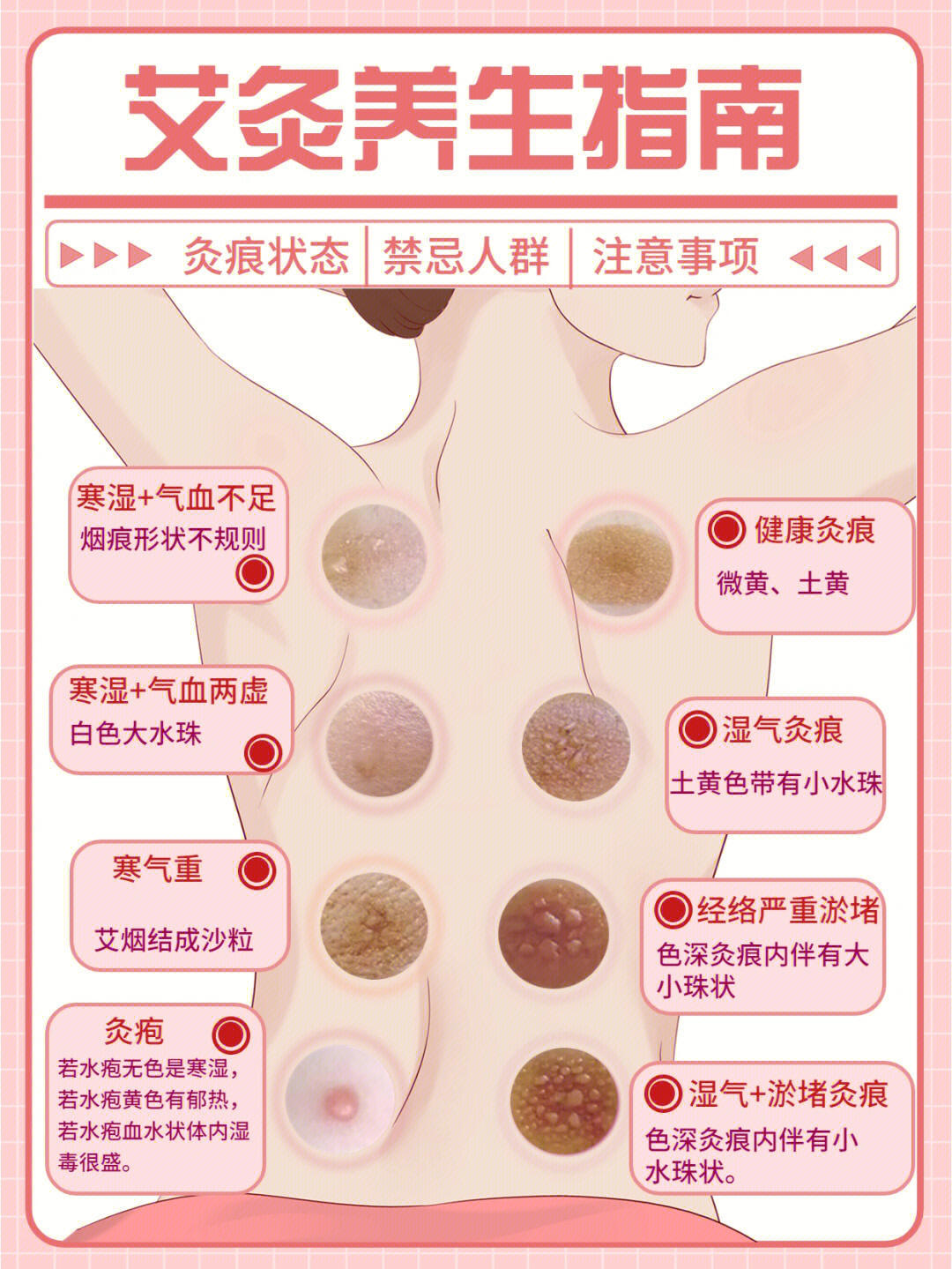 艾灸最新指南详解