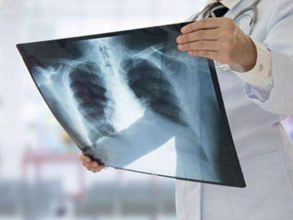 全球抗击疫情最新进展,最新肺炎官方动态与策略更新